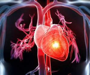 Người bệnh tim mạch có nên sử dụng nếp cẩm?